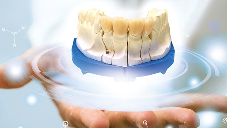 What is all-on-4 dental implant technology