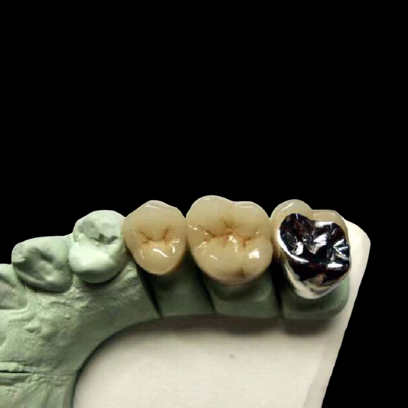 Digital Dental Lab Crowns