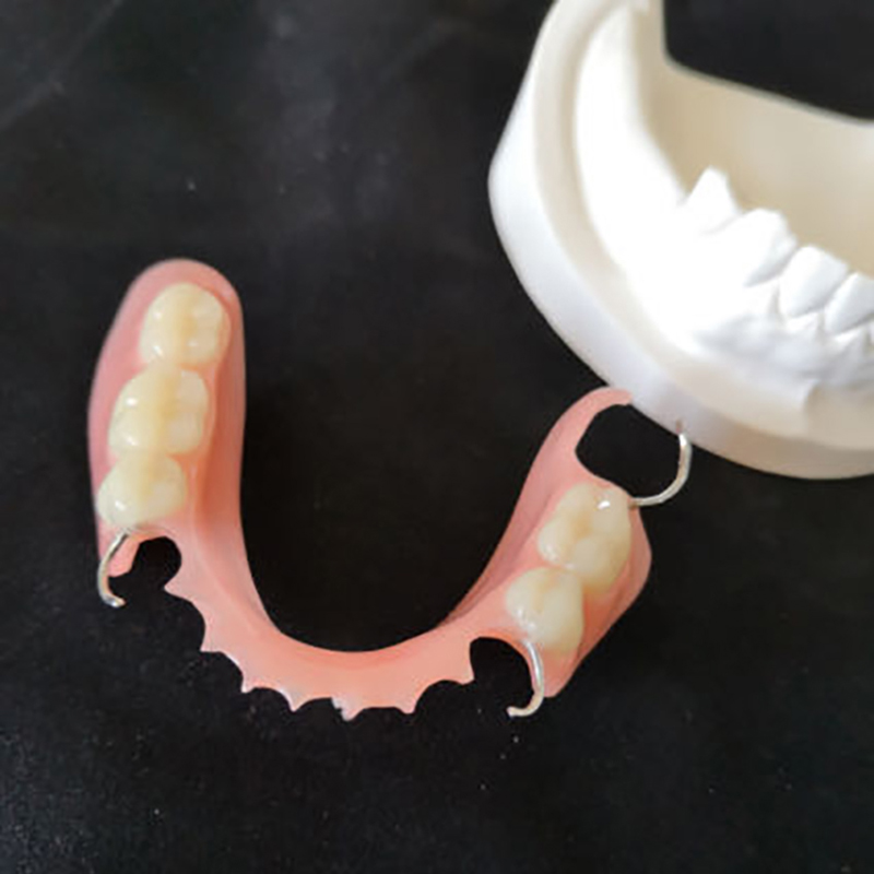 Removable Dentures
