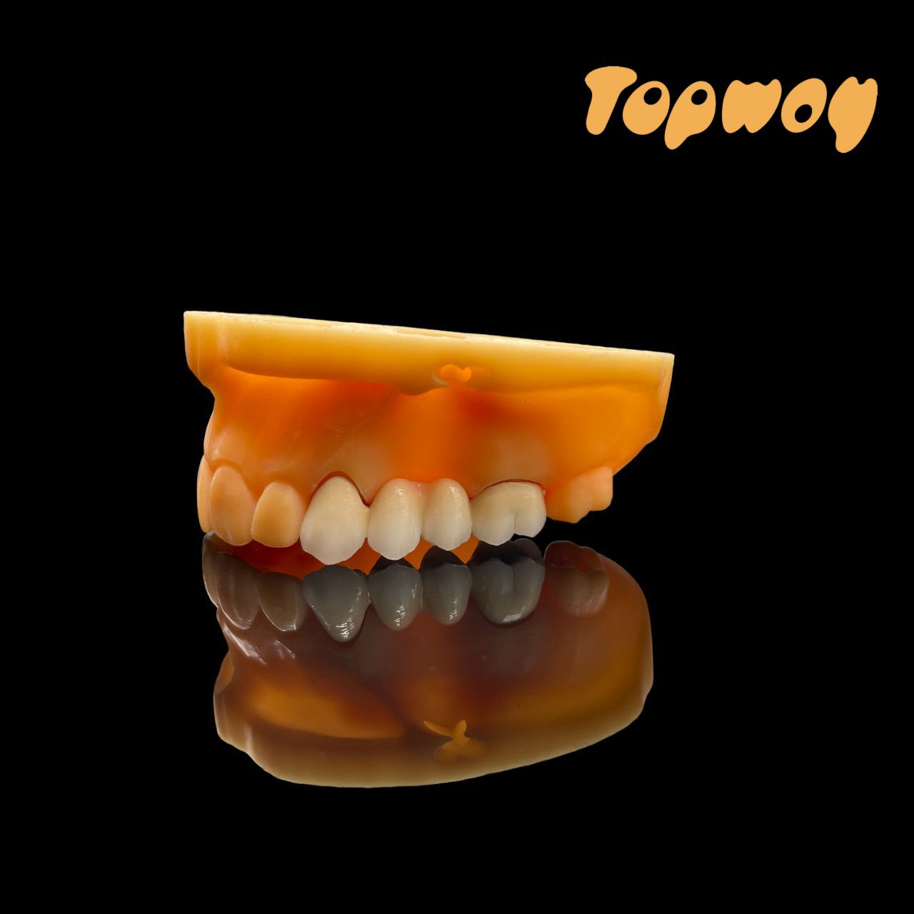 PFM Crowns and bridge (Porcelain-Fused-to-Metal)