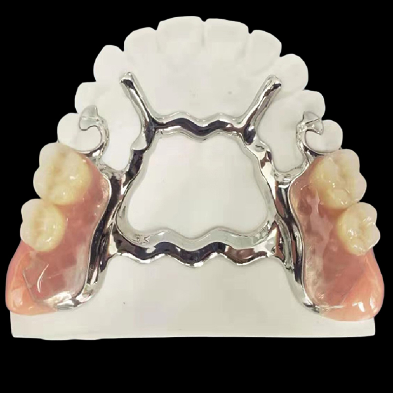 Dental Dentures Metal Framework