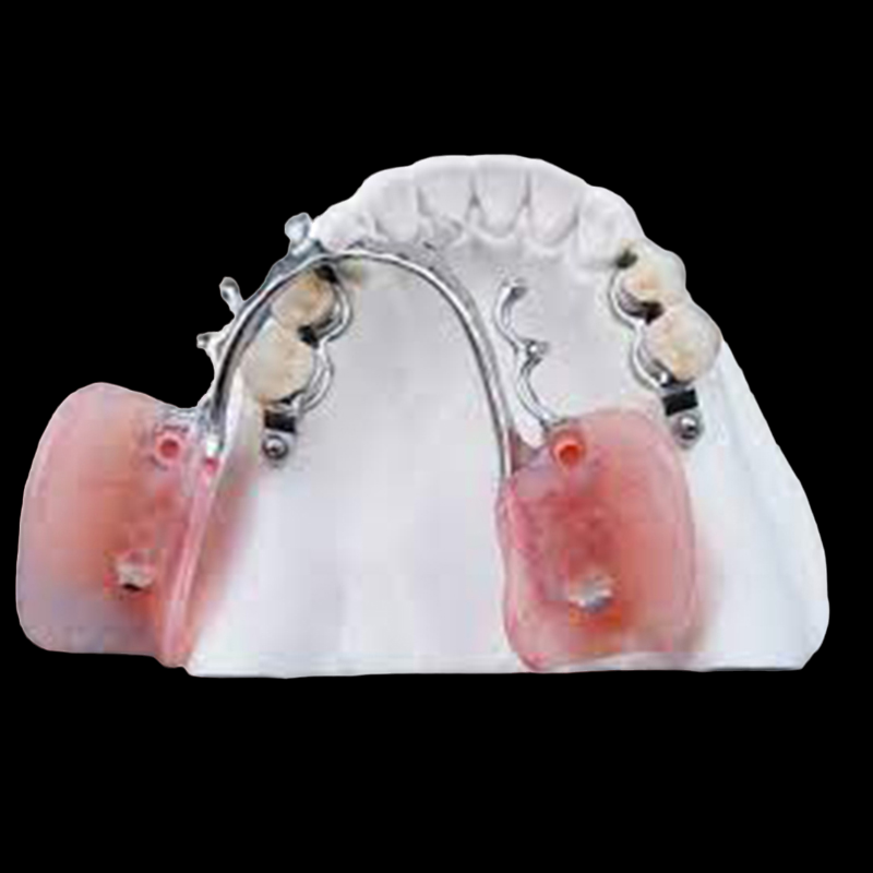 Dental Denture Attachment