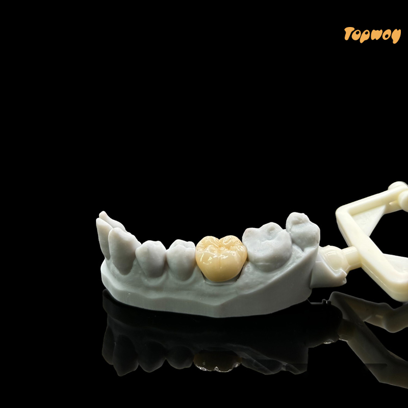 Full Zirconia Dental Case