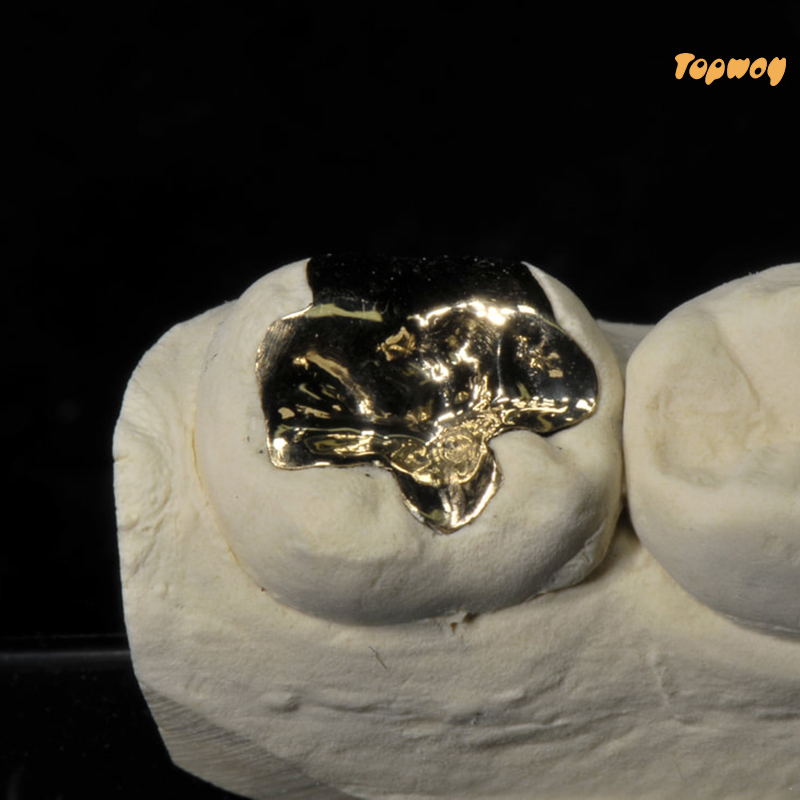 Full Metal Crowns