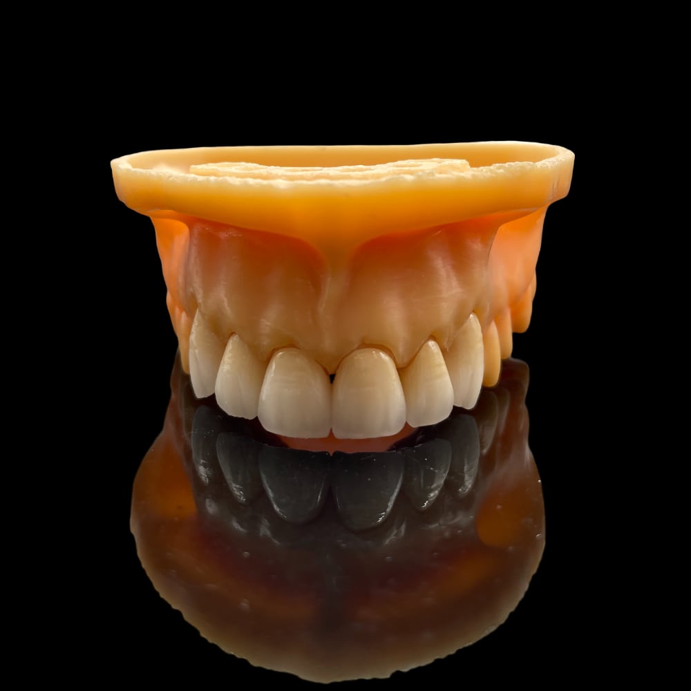 Digital Zirconia Crowns and Bridge