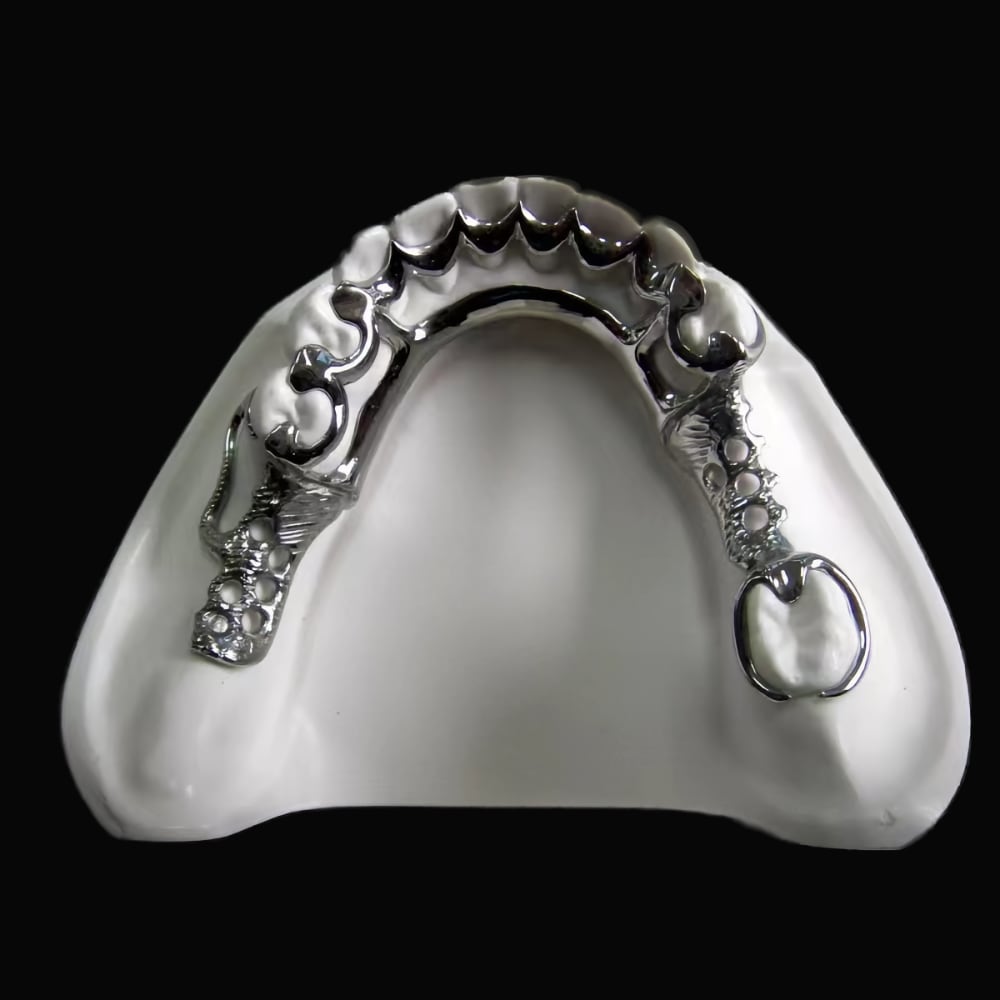 Dental Vitallium Denture