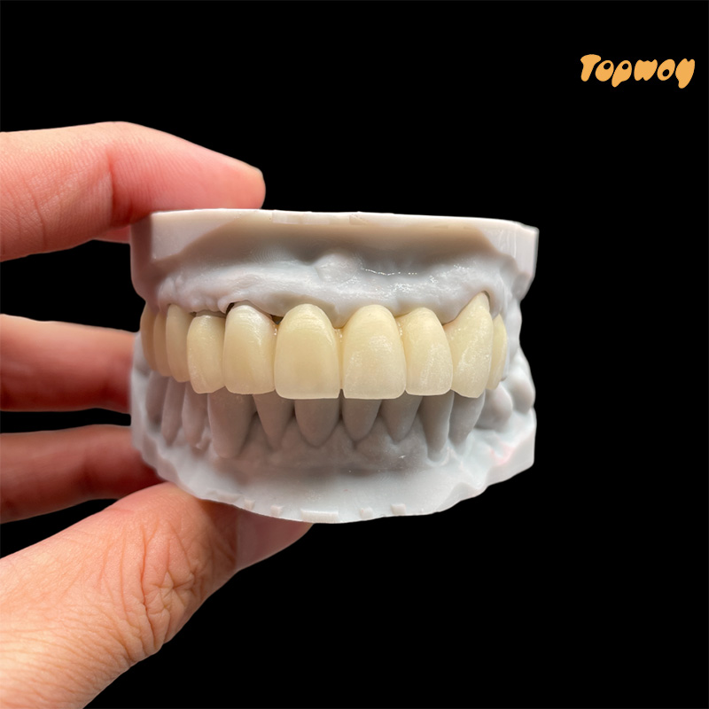 Esthetics Zirconia Dental Lab Crowns Bridge