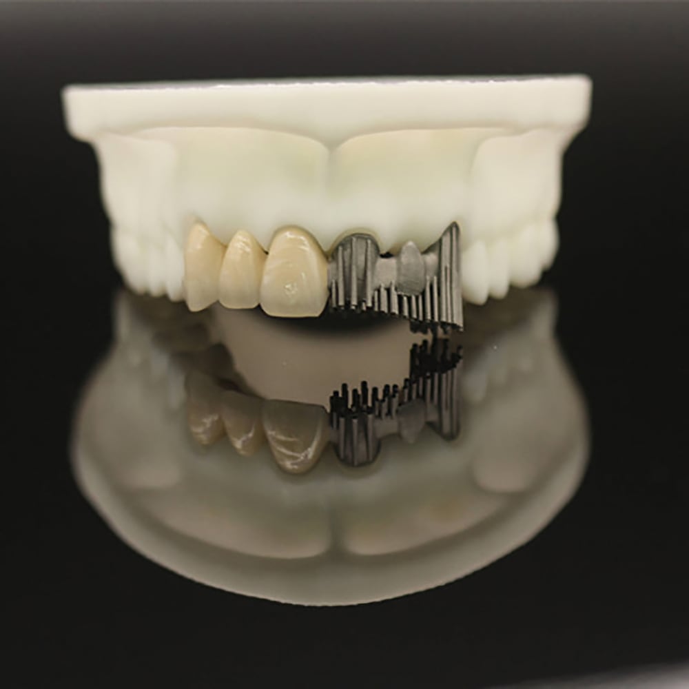 Dental Lab PFM Crowns and Bridge