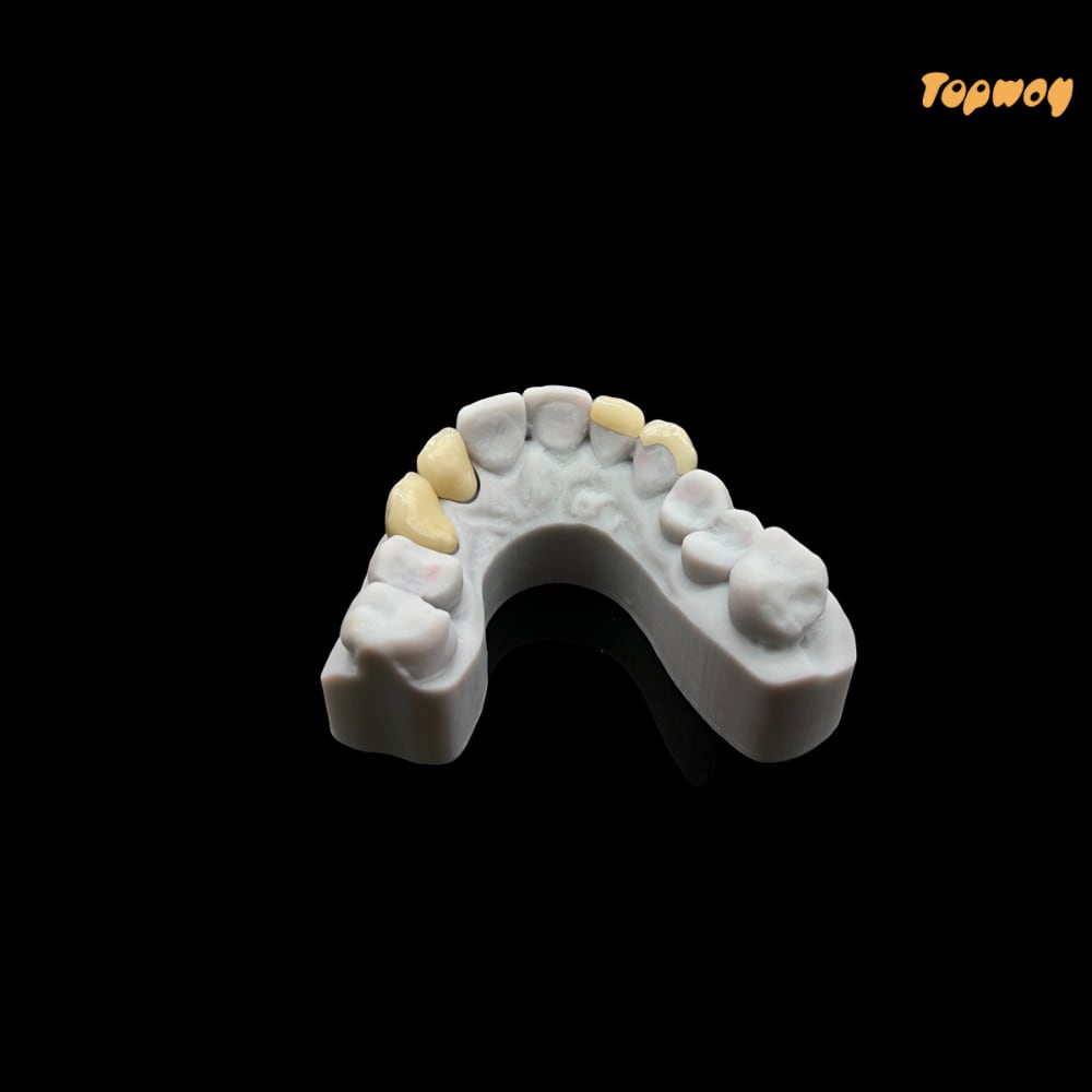 Dental Lab 3D Print Full Arch Model